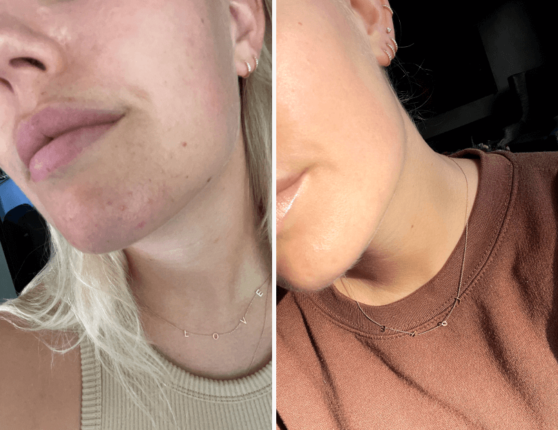 <h1><strong>Ergebnisse für regenerierte Haut</strong></h1>