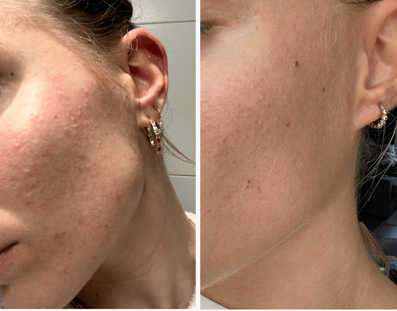 <h1><strong>Ergebnisse für regenerierte Haut</strong></h1>