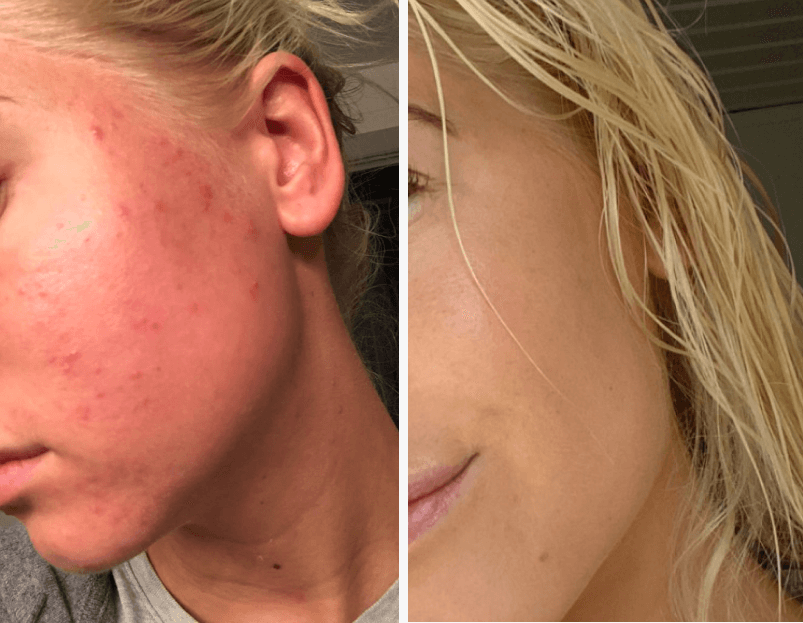 <h1><strong>Ergebnisse für regenerierte Haut</strong></h1>