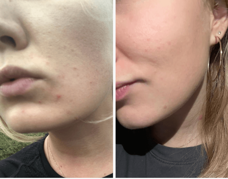 <h1><strong>Ergebnisse für regenerierte Haut</strong></h1>